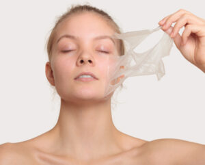 VI Chemical Peels Agoura Hills