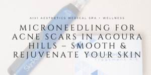 Microneedling for Acne Scars in Agoura Hills – Smooth & Rejuvenate Your Skin