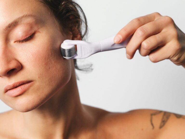 microneedling