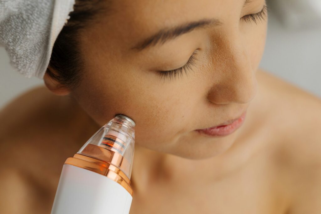 Microneedling
