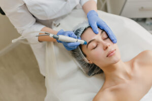 Facial Rejuvenation